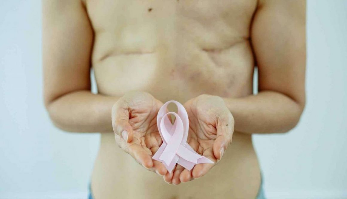 mulher-segura-laco-simbolo-da-luta-contra-o-cancer-de-mama-no-fundo-ela-tem-cicatrizes-nos-seios